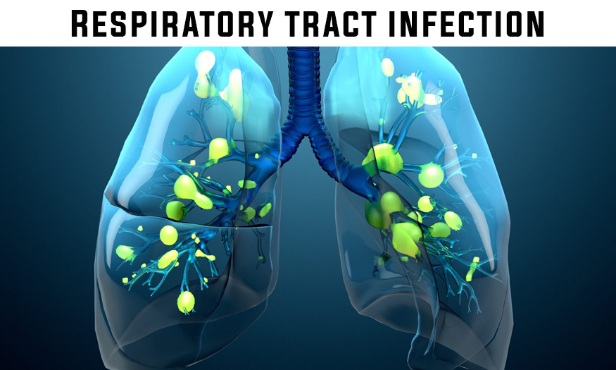 Doctor For Respiratory Tract Infections